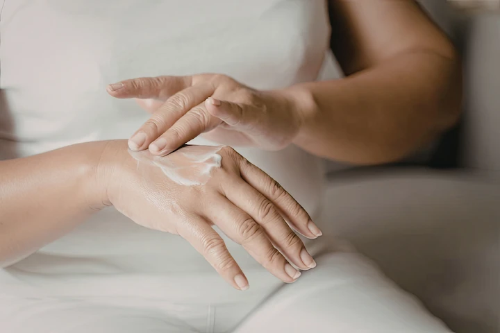 Topical cream being applied directly to the hand area